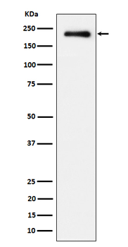 EGFR (Phospho-Tyr869) Rabbit mAb Antibody