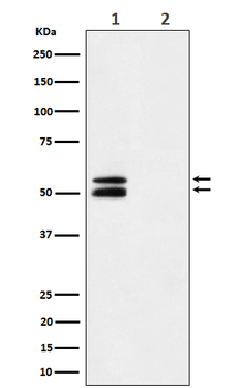 CaMKII alpha (Phospho-Thr286) Rabbit mAb Antibody