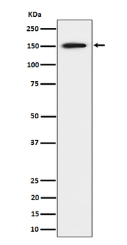 SAFB Rabbit Monoclonal Antibody