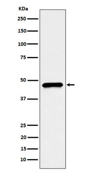CECR5 Rabbit Monoclonal Antibody