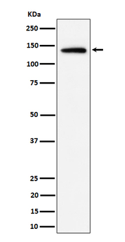 Importin 9 / RANBP9 Rabbit mAb Antibody