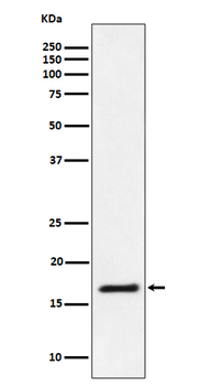 Ube2L3 / UBCH7 Rabbit mAb Antibody