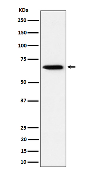 Sterol carrier protein 2 Rabbit Monoclonal Antibody