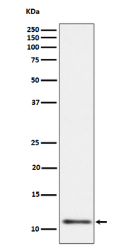 UQCRH Rabbit mAb Antibody