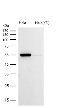 CAP1 Rabbit mAb [KD Validated] Antibody