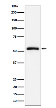 CAP1 Rabbit mAb [KD Validated] Antibody