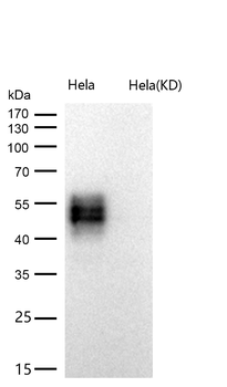 CD58 Rabbit mAb [KD Validated] Antibody