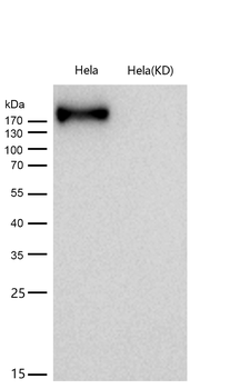 CHD3 Rabbit mAb [KD Validated] Antibody