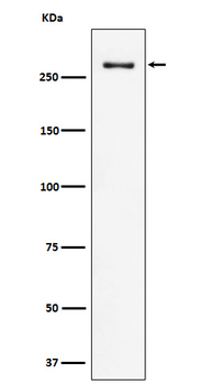 CHD3 Rabbit mAb [KD Validated] Antibody