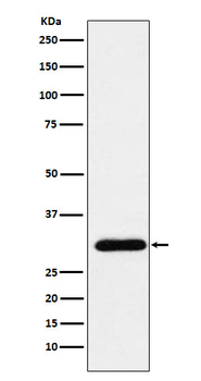 GTF2F2 Rabbit mAb Antibody