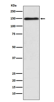 COL11A1 Rabbit Monoclonal Antibody