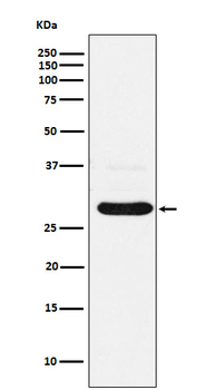 CHMP2B Rabbit mAb [KD Validated] Antibody