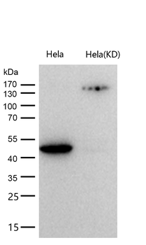 CSK Rabbit mAb [KD Validated] Antibody