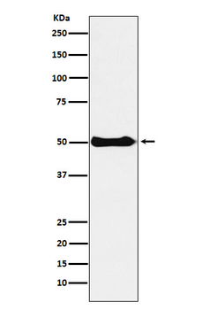 CSK Rabbit mAb [KD Validated] Antibody