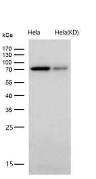 DLAT Rabbit mAb [KD Validated] Antibody
