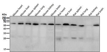 ABCE1 Rabbit mAb [KD Validated] Antibody