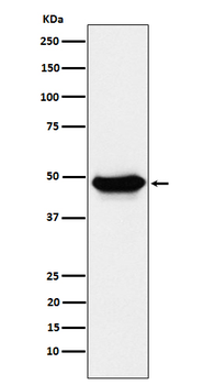 ENTPD5 Rabbit Monoclonal Antibody