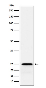 GSTK1 Rabbit mAb Antibody