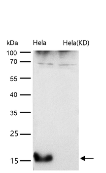 AP2S1 Rabbit mAb [KD Validated] Antibody