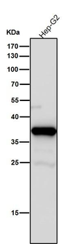 AKR1C3 Rabbit mAb Antibody