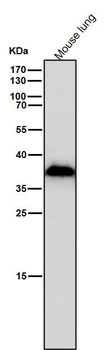 AKR1C3 Rabbit mAb Antibody