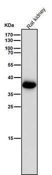 AKR1C3 Rabbit mAb Antibody