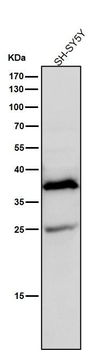 AKR1C3 Rabbit mAb Antibody