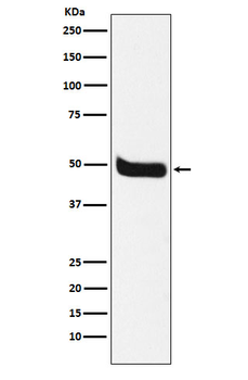 Neurokinin 1 Receptor Rabbit Monoclonal Antibody