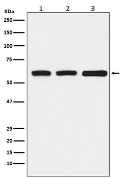 KAT9 / Elp3 Rabbit mAb Antibody