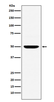 MUM1 Rabbit Monoclonal Antibody