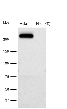 CHD3 Rabbit mAb [KD Validated] Antibody