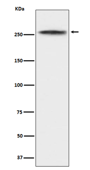 CHD3 Rabbit mAb [KD Validated] Antibody