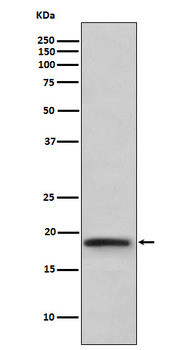 TNF beta Rabbit mAb Antibody