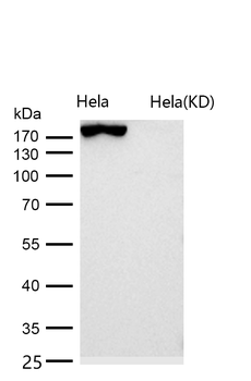 Clathrin heavy chain Rabbit mAb [KD Validated] Antibody