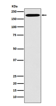 Clathrin heavy chain Rabbit mAb [KD Validated] Antibody