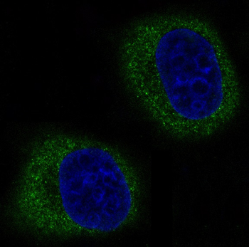 Mitofusin 2 Rabbit mAb Antibody