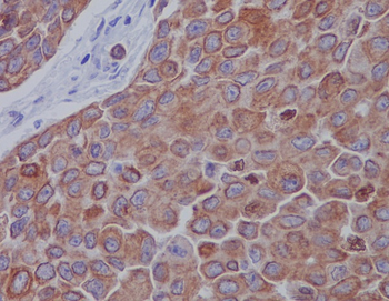Mitofusin 2 Rabbit mAb Antibody