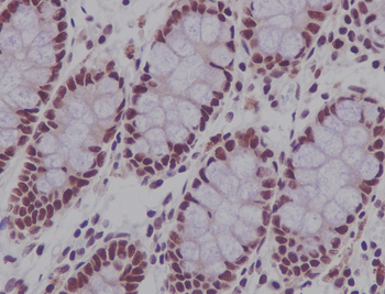 CDCA5 Rabbit mAb Antibody