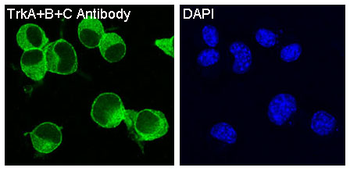 TrkA+B+C Rabbit mAb Antibody