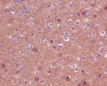 TrkA+B+C Rabbit mAb Antibody