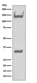 TrkA+B+C Rabbit mAb Antibody