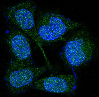 MEK3/MEK6 Rabbit mAb Antibody