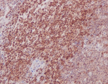 MEK3/MEK6 Rabbit mAb Antibody