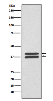 MEK3/MEK6 Rabbit mAb Antibody