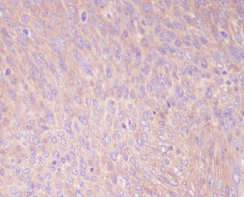 PKM2 Rabbit mAb Antibody