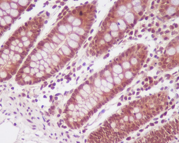 PP2A alpha + beta Rabbit mAb Antibody