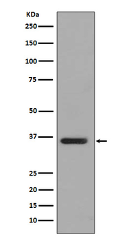 PP2A alpha + beta Rabbit mAb Antibody