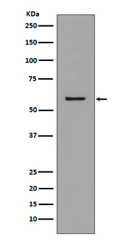 CCR3 Rabbit mAb Antibody