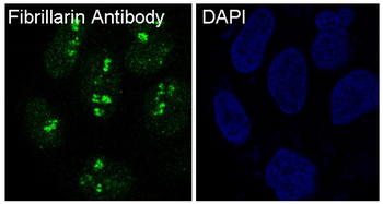 Fibrillarin Rabbit mAb Antibody