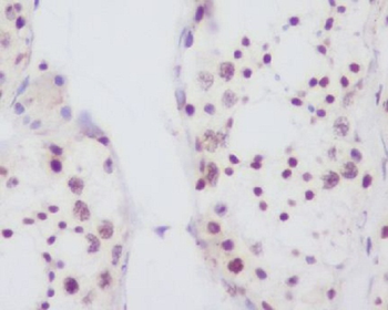 Fibrillarin Rabbit mAb Antibody